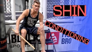 How To Condition Your Shins | Stephen Wonderboy Thompson