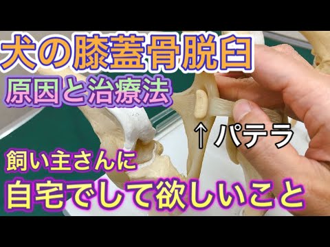 足の脱臼 – 脱臼の概要、症状、治療方法