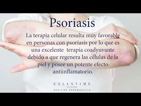 A Patient-Friendly Guide to Undergoing Advanced Stem Cell Therapy for Psoriasis in Mexico