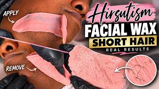 Waxing Short Facial Hair! #Hirsutism 