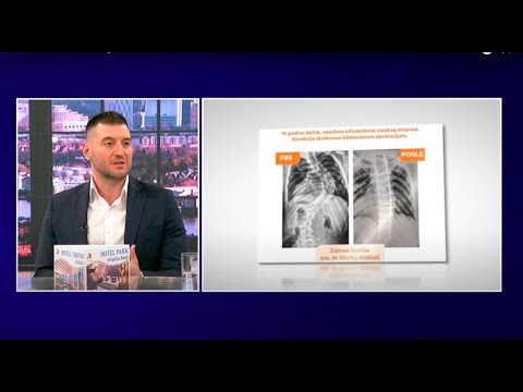 Rtv Pink - Novo Jutro - dr Marko Aleksić - tegobe sa kičmom kod mladih