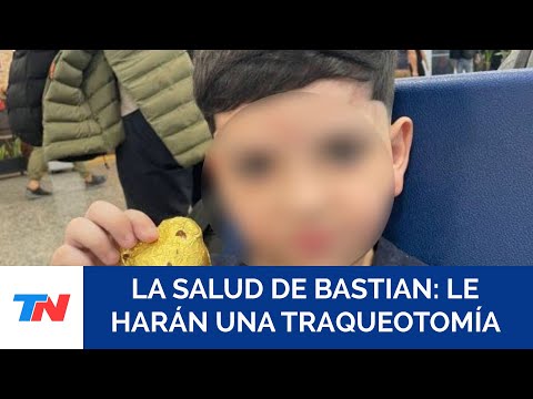 El nene de 8 años que sufrió un accidente en Pinamar sigue grave y le harán una traqueotomía
