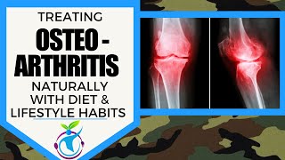 How To Manage OSTEOARTHRITIS with Food & Lifestyle habits