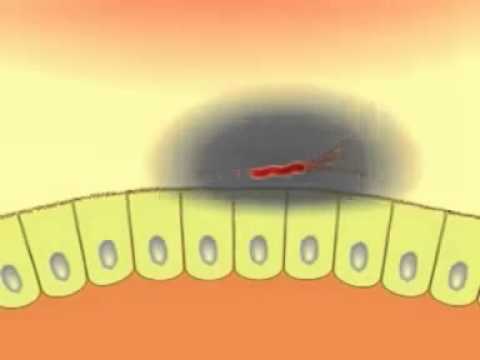 comment soigner naturellement helicobacter pylori