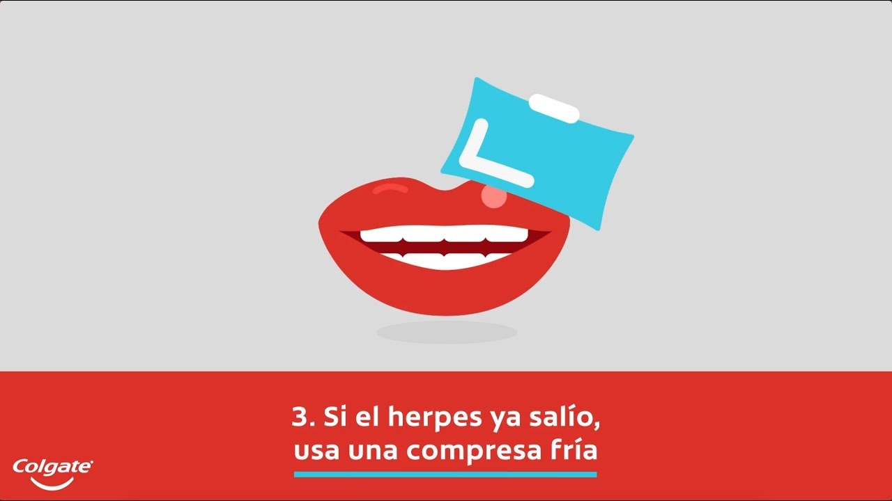 Watch Herpes Labial – Cómo Aliviarlos | Colgate® Now Herpes Labial – Cómo Aliviarlos | Colgate®