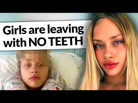 Girls are being lured to these "parties"... and leaving without teeth.