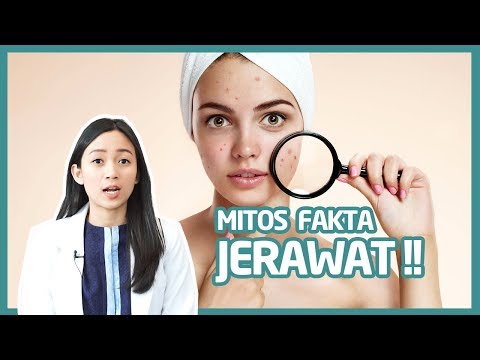 Cara Menghilangkan Jerawat Fakta, artikel Cara Menghilangkan Jerawat Fakta gratis, video trending Cara Menghilangkan Jerawat Fakta