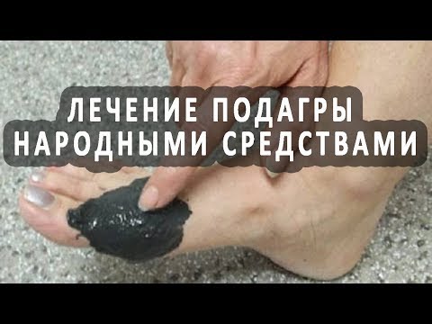 Тайские мази при остеохондрозе поясничного отдела Спондилеза межпозвонкового остеохондроза