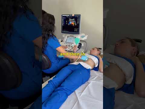 Is that My Pancreas!? Interpret a Live Ultrasound Scan with Us! 🖥️ #ultrasound #letslearn