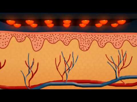 image-Is infrared light high or low energy?