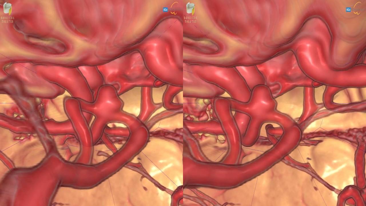 Eliseu Becco Neto-15
