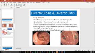GI Part 4 (Diverticulitis & Celiac)