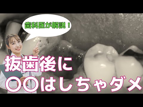 生命歯学科 抜歯後の注意点！抜歯後の痛み腫れを小さくするためにできること　抜歯後の食事・歯磨きについて　血が止まらないかもそう思った時の対処法を解説