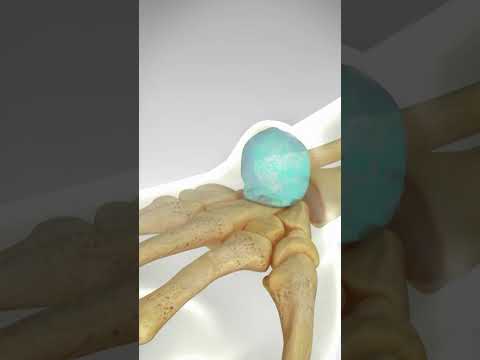 Guess The Spine Injury And Procedure Challenge