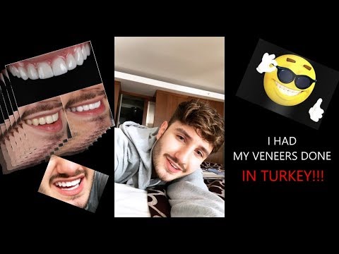 I HAD MY VENEERS DONE IN TURKEY!