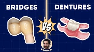 Treatment Planning Bridges vs Dentures - The Art and Science - PDP198