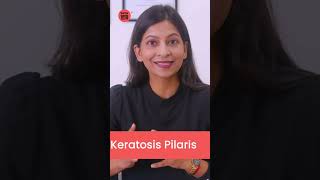Keratosis Pilaris: How to Get Rid of Black Bumps on Buttoks, Arms or Legs #shorts #tata1mg