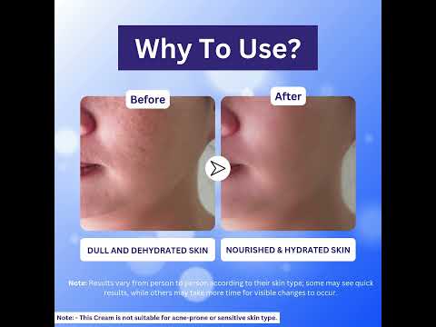 A+ soothing cream for normal to dry skin types face moisturi...