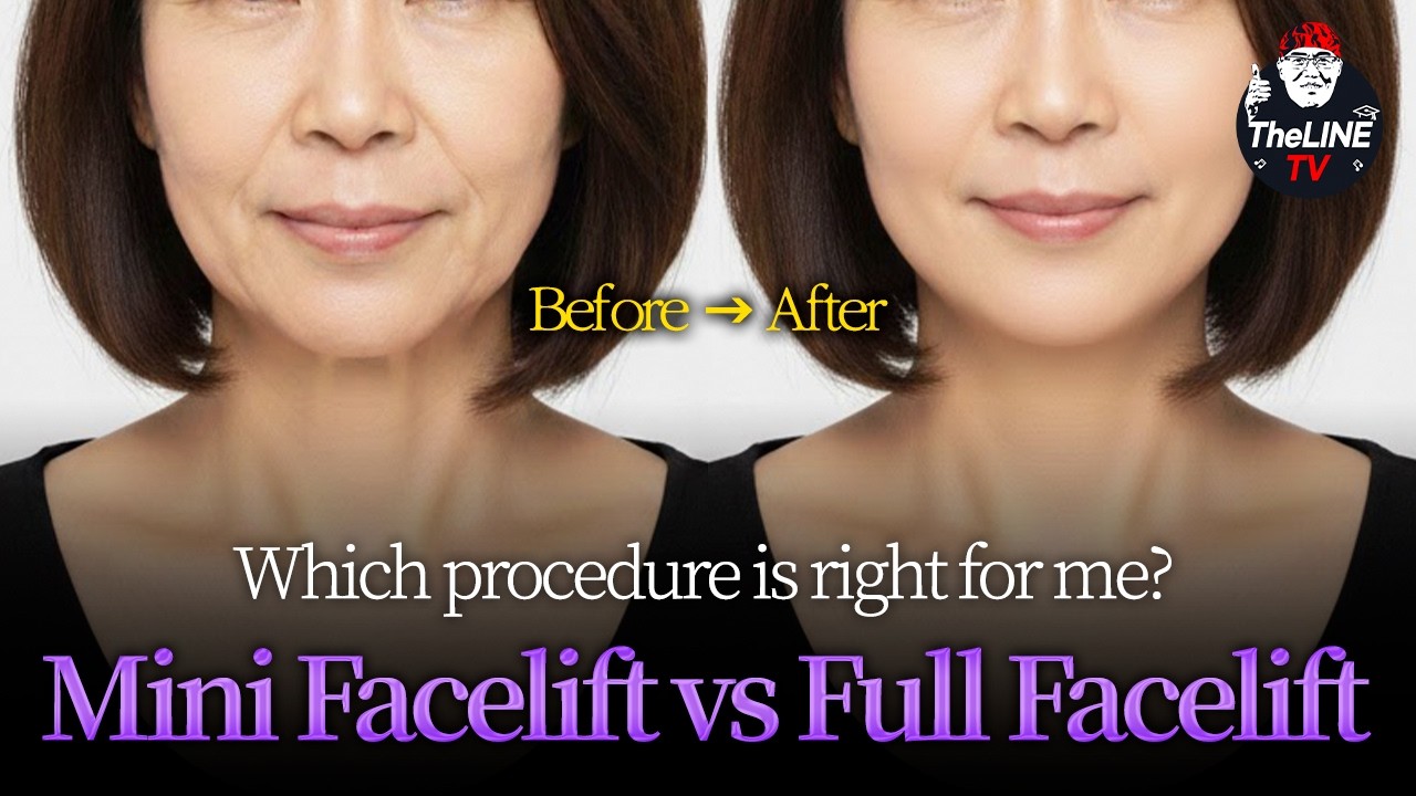 Surgeons explain the Mini Facelift for a youthful look - TheLINE Plastic Surgery video