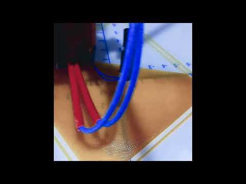 Delta 3D printer First layer @0.2mm
