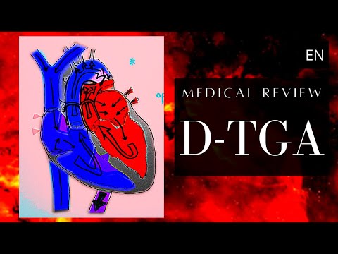 Understanding D-Transposition of the Great Arteries