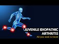 Juvenile Idiopathic Arthritis: Everything You Need To Know