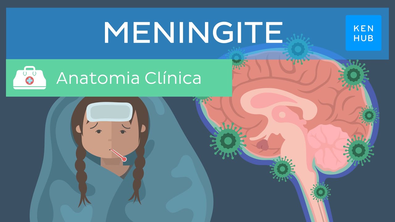 Meningite: Definição, tipos, sintomas, diagnóstico e tratamento | Kenhub