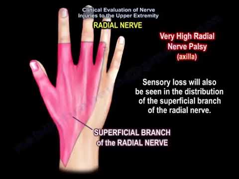 radial nerve injury, wrist drop, anatomy of the radial nerve.