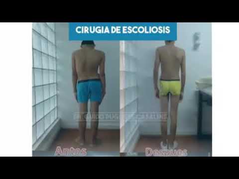 video G6SwwBCwHtU