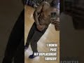 1 MONTH POST DOUBLE HIP REPLACEMENT SURGERY #hipreplacementrecovery #damianbaileyfitness