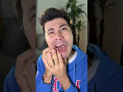 dişim çürüdüğünde benim haller 🦷😂