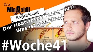 Das Minoxidil Experiment #Woche41 Haarwachstumszyklus und Shedding!
