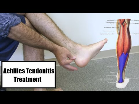 térdszinovitis sérüléskezelés után fáj a lábak térdízületei amelyek segítenek