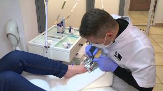 Podoexpert - Lesson1 - Twisted Big Toenail