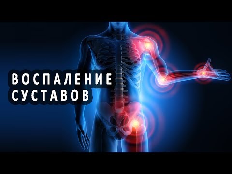 Крем жирный от суставов Боль в животе и в пояснице причины