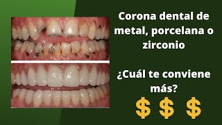 ¿Necesitas una corona dental ¿Cuánto cuesta 2022