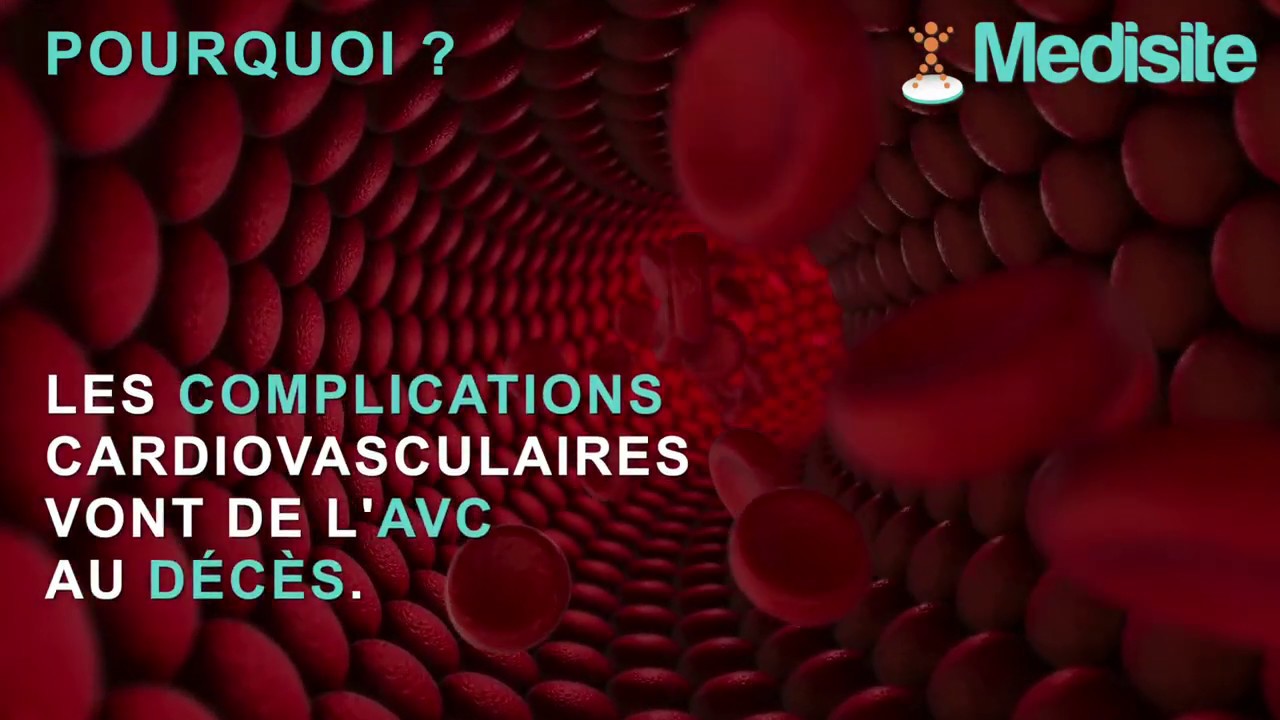 Top 3 des médicaments dangereux pour votre cœur