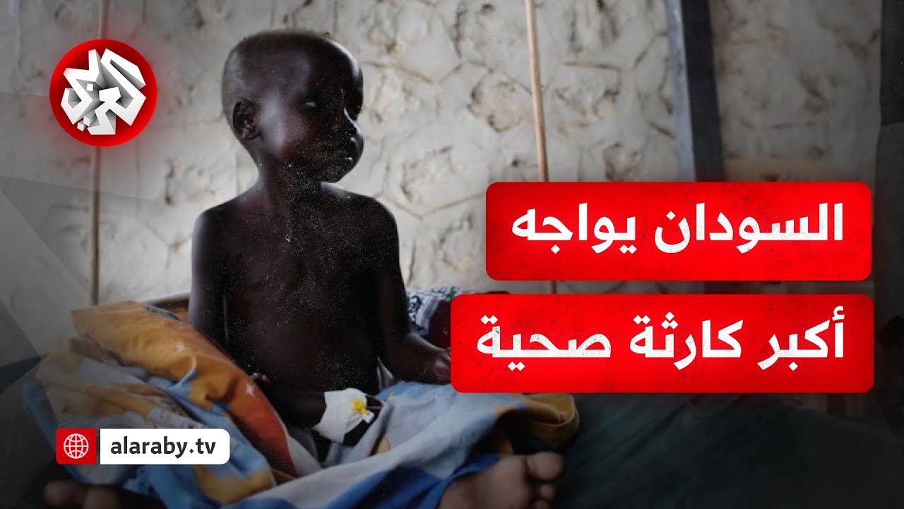 حرب السودان تخفي كارثة.. وباء خطير ينتشر بسرعة جنونية في السودان وعدد الإصابا