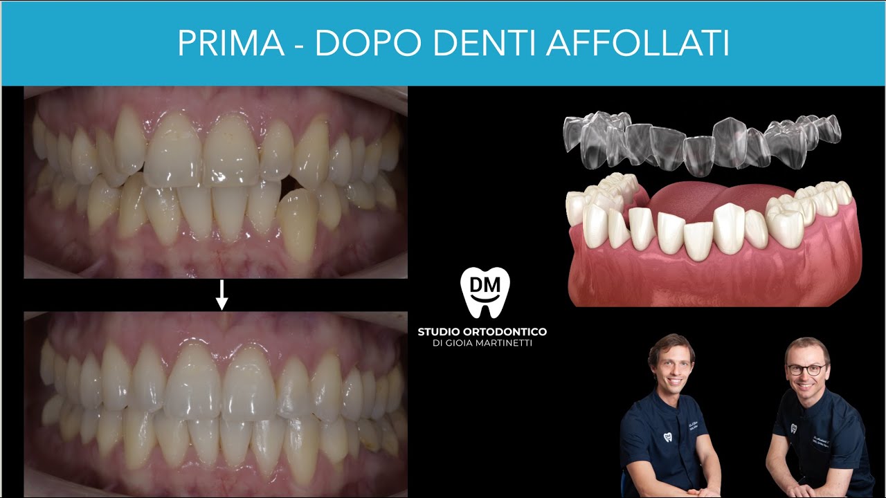 Francesco Martinetti-17