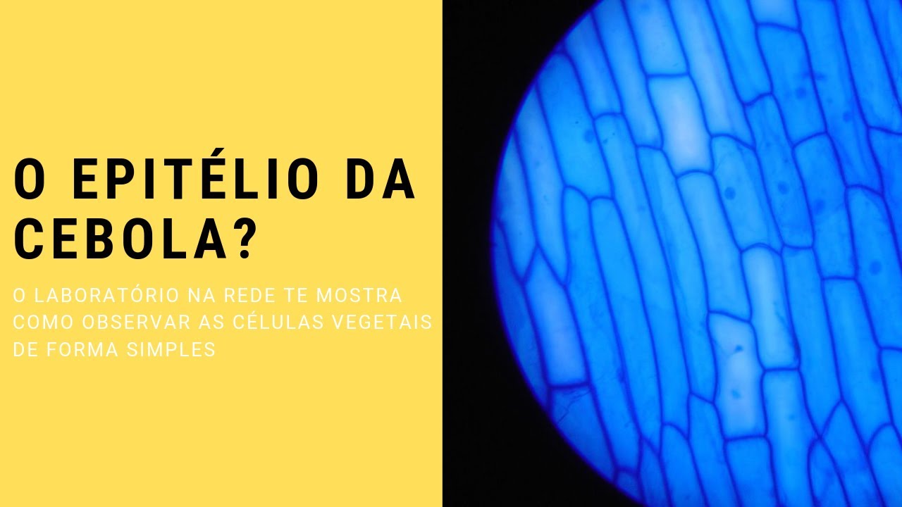 O MUNDO MICROSCÓPICO DAS CÉLULAS VEGETAIS: O EPITÉLIO DA CEBOLA