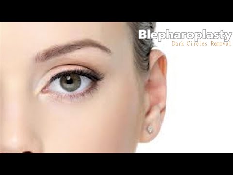 ❉ Powerful Blepharoplasty! ~ Dark Circles & Eye Bags Removal + Radiant Youthful Skin ~ Ocean Sounds