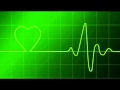 Adios Control - Heartbeat 