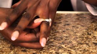 Skin Irritations From a Wedding Ring : All-Natural Care