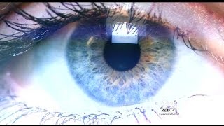 New Procedure Changes Brown Eyes To Blue