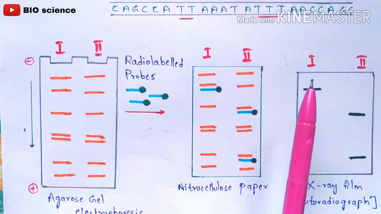 RFLP - Restriction fragment length polymorphism | Molecular markers | RFLP mapping | Bio science