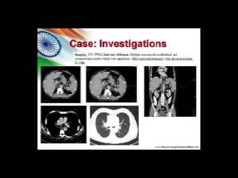 CPC Medical Oncology