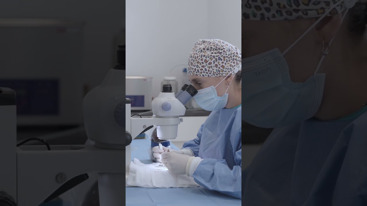 Miniatura filmu Przebieg zabiegu FUE