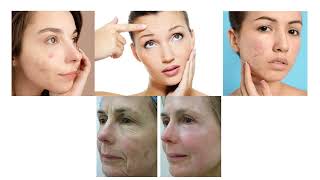 Idyllic Aesthetics San Fransisco | Boutique Medical Spa