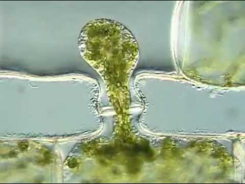 #algae#Scalariform conjugation #sexaul reproduction #spirogyra reproduction #Avinash