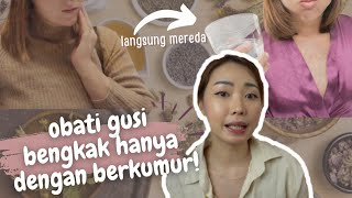 Download lagu Mengobati Gusi Bengkak Hanya Dengan Berkumur!! mp3 Download lagu Mengobati Gusi Bengkak Hanya Dengan Berkumur!! mp3